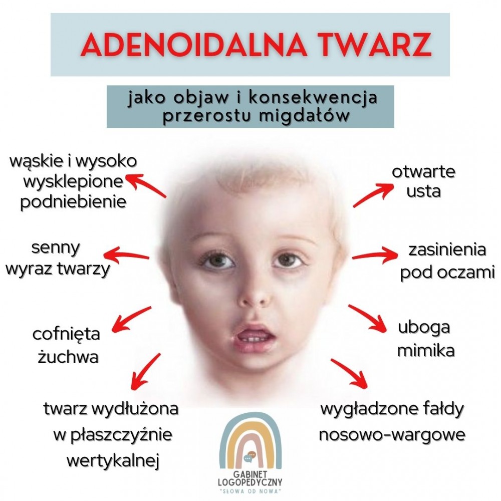 Przerost migdałków - warto znać objawy 
